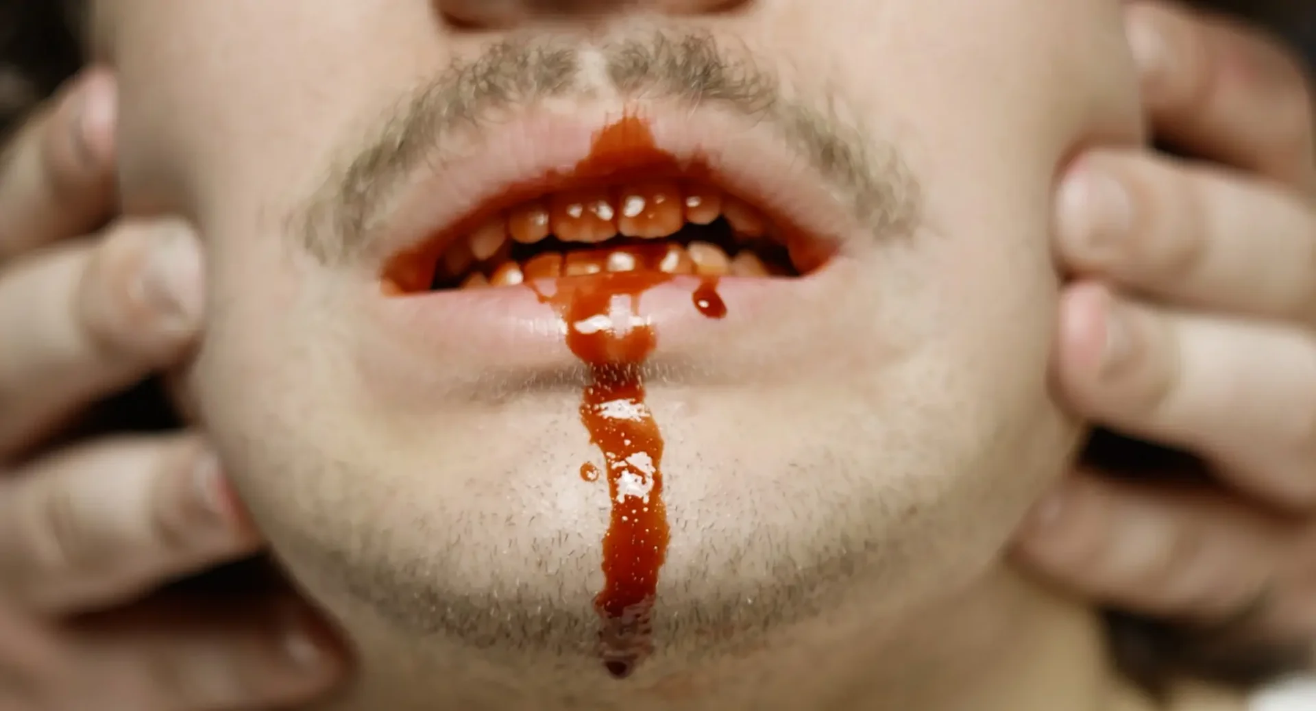 Film still: extreme close-up of a face with bloody teeth being held in place by two hands from behind.