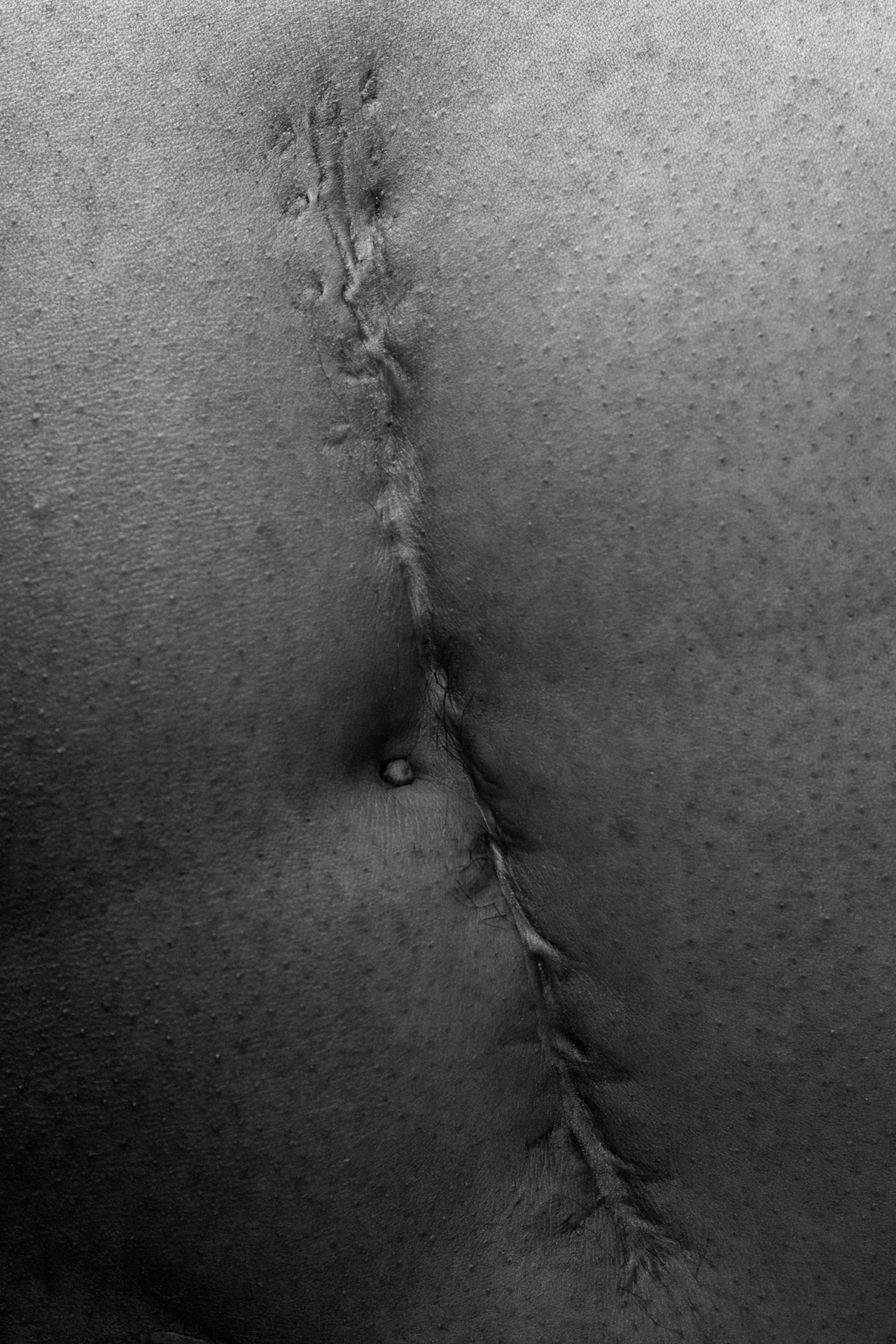 Close up of a single line scar.